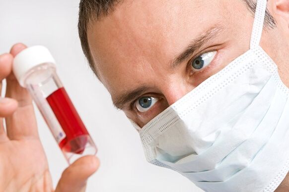xét nghiệm máu tìm vi rút u nhú ở người